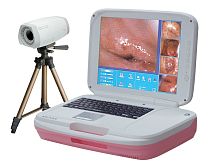 Video colposcope AD-2000Y transportable