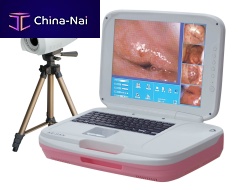 Video colposcope AD-2000Y transportable