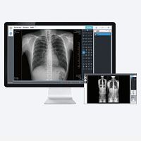 Radiography software EConsole1 acquisitionAIbone