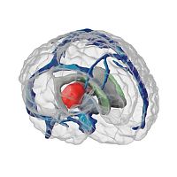 Radiosurgery test phantom ANATDELfor radiographybrain