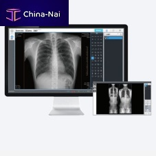 Radiography software EConsole1 acquisitionAIbone