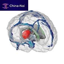 Radiosurgery test phantom ANATDELfor radiographybrain