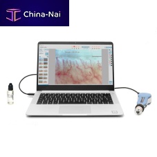 Video capillaroscope DM-120 CapiScope seriescomputer-based