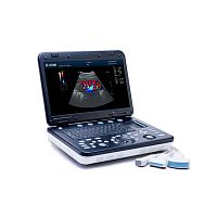 Portable ultrasound system KC7for gynecological and obstetric ultrasound imagingfor abdominal and pelvic ultrasound imagingfor urology ultrasound imaging