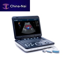 Portable ultrasound system KC7for gynecological and obstetric ultrasound imagingfor abdominal and pelvic ultrasound imagingfor urology ultrasound imaging