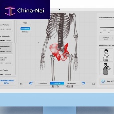 Balance evaluation system Moti Physio miniposturekinematic analysis