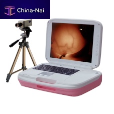Video colposcope AD-1202transportable