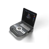 Portable ultrasound system SIFULTRAS-8.31for gynecological and obstetric ultrasound imagingfor abdominal and pelvic ultrasound imagingfor urology ultrasound imaging