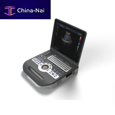 Portable ultrasound system SIFULTRAS-8.31for gynecological and obstetric ultrasound imagingfor abdominal and pelvic ultrasound imagingfor urology ultrasound imaging