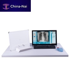 Radiography acquisition system ddRAura