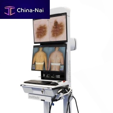 Video dermatoscope IntelliStudio3white LEDcomputer-based