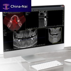 Dental imaging software QuickVision 3Dfor dental implantologyvisualizationanalysis