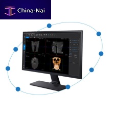 Dental software SmartVProCTfor dental imagingfor dental laboratories