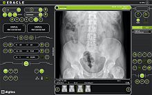 Medical imaging software ERACLEdiagnosticacquisitionimage enhancement