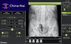 Medical imaging software ERACLEdiagnosticacquisitionimage enhancement