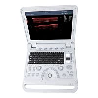 Portable ultrasound system CMS600P2PLUSfor gynecological and obstetric ultrasound imagingfor abdominal and pelvic ultrasound imagingfor urology ultrasound imaging