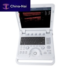 Portable ultrasound system CMS600P2PLUSfor gynecological and obstetric ultrasound imagingfor abdominal and pelvic ultrasound imagingfor urology ultrasound imaging