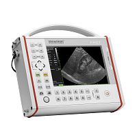 Portable ultrasound system FASTfor gynecological and obstetric ultrasound imagingfor urology ultrasound imagingfor abdominal and pelvic ultrasound imaging