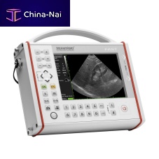 Portable ultrasound system FASTfor gynecological and obstetric ultrasound imagingfor urology ultrasound imagingfor abdominal and pelvic ultrasound imaging