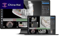 Medical software Implant 3Dfor dental surgeryCTfor guided surgery