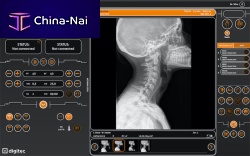 Anatomical imaging software TESEO for orthopedic imagingradiographydiagnostic
