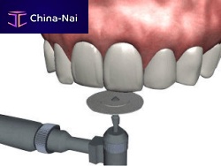 Dental surgery software NA501 periodontaltreatmenteducation
