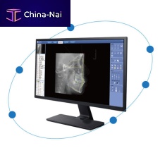 Medical imaging software CephPro3Dorthodonticclinicalanalysis