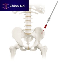 Bone marrow biopsy needle RETRIEVE®