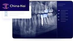 Dental surgery software Allisonefor dental implantologyfor x-ray imagingvisualization